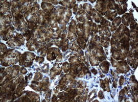 ACADS Antibody