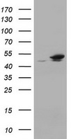 EPHX1 Antibody