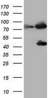 Factor XIIIa Antibody