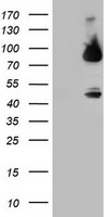 Factor XIIIa Antibody