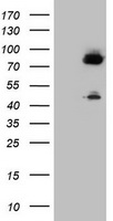 Factor XIIIa Antibody