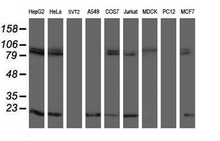 TPRKB Antibody