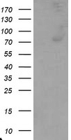 C1R Antibody