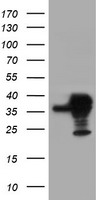 SERPINB1 Antibody