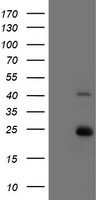 UBE2E3 Antibody