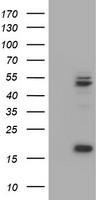UQCRC1 Antibody