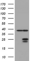 UBE2E3 Antibody