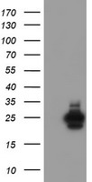 UBE2E3 Antibody