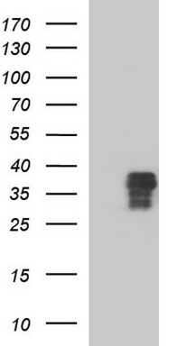 ZFAND3 Antibody
