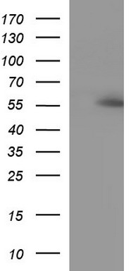 ANKMY2 Antibody