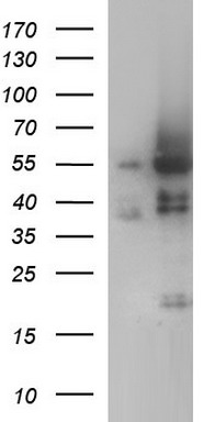 ANKMY2 Antibody