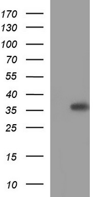 HORMAD2 Antibody
