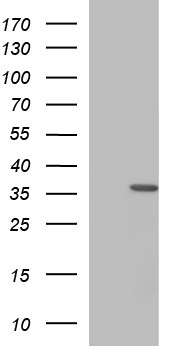HORMAD2 Antibody