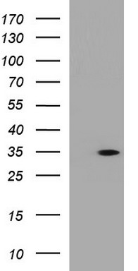 ANKRD49 Antibody