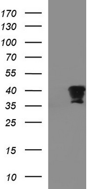 FNDC8 Antibody