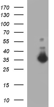 FNDC8 Antibody