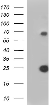 VEGFB Antibody