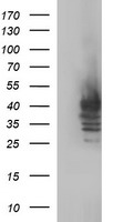 Sex Hormone Binding Globulin Antibody