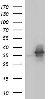 NFKBIA Antibody