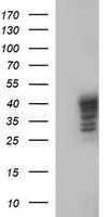 Sex Hormone Binding Globulin Antibody