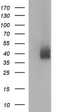 PD-L1 Antibody