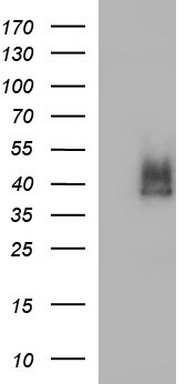 PD-L1 Antibody
