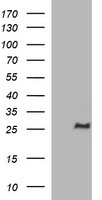 CHAC1 Antibody