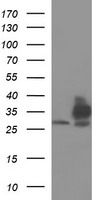 TMX1 Antibody