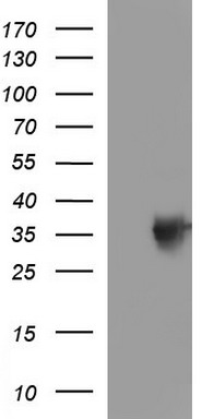 TOLLIP Antibody
