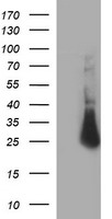 CHAC1 Antibody