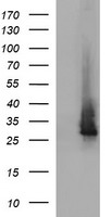 CHAC1 Antibody