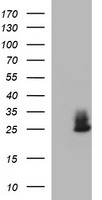 CHAC1 Antibody