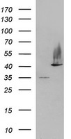 SERPINB3 Antibody