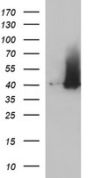 SERPINB3 Antibody