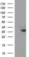 TOLLIP Antibody