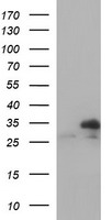 TXNDC Antibody