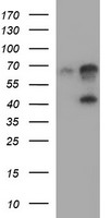 SERPINB3 Antibody