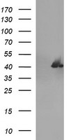SERPINB3 Antibody