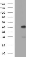 SERPINB3 Antibody