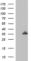POLR3GL Antibody