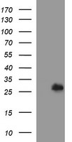 DTD1 Antibody