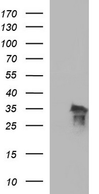 POLR3GL Antibody