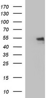IL6R Antibody