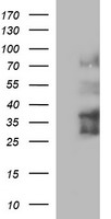 IL1A Antibody