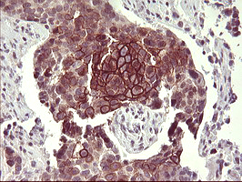 CD44 Antibody