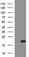 SIVA1 Antibody