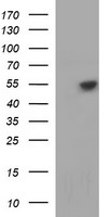 TUBB1 Antibody