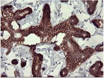 CD44 Antibody