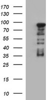 FOXP1 Antibody