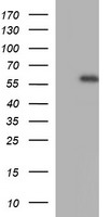 MMP13 Antibody